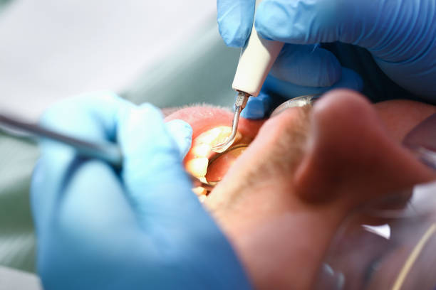 Best Urgent Dental Care for Toothaches in Copperopolis, CA