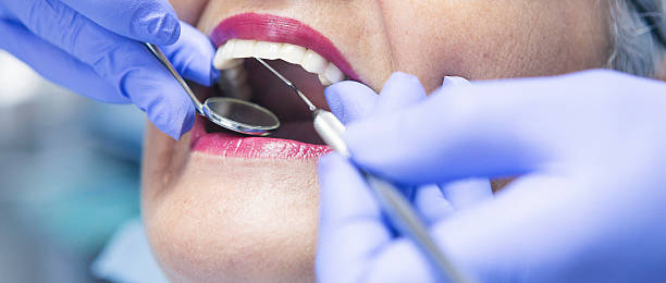 Best Emergency Cosmetic Dentistry (e.g., broken veneers) in Copperopolis, CA